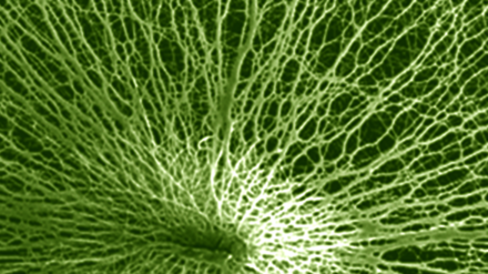 Organisation en étoile de nanofibres de poly(ε-caprolactone) obtenues par electrospinning sur collecteur microstructuré - © Copyright Pr G. Schlatter et CNRS P. Didier (g) et Pr. G. Schlatter (d)