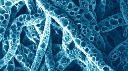Nanofibres poreuses de poly(ε-caprolactone) / cyclodextrine obtenues par « leaching » sélectif - © Copyright Pr. Guy Schlatter