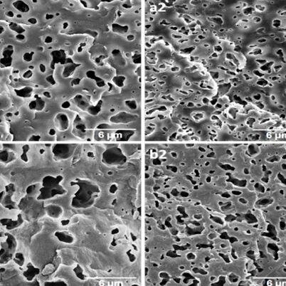 Elastomère thermoplastique nanostructuré